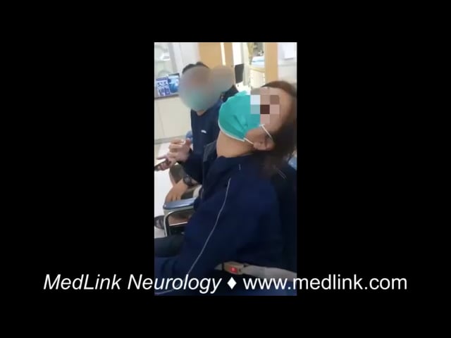Acute dystonic reaction