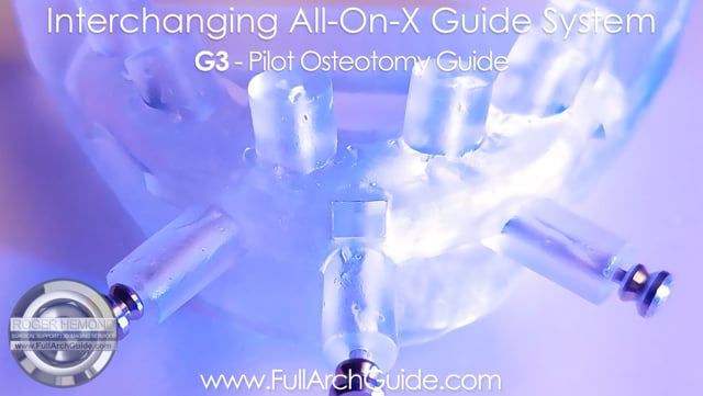 Interchanging All on X Guide System - A More Stable Alternative to Stackable