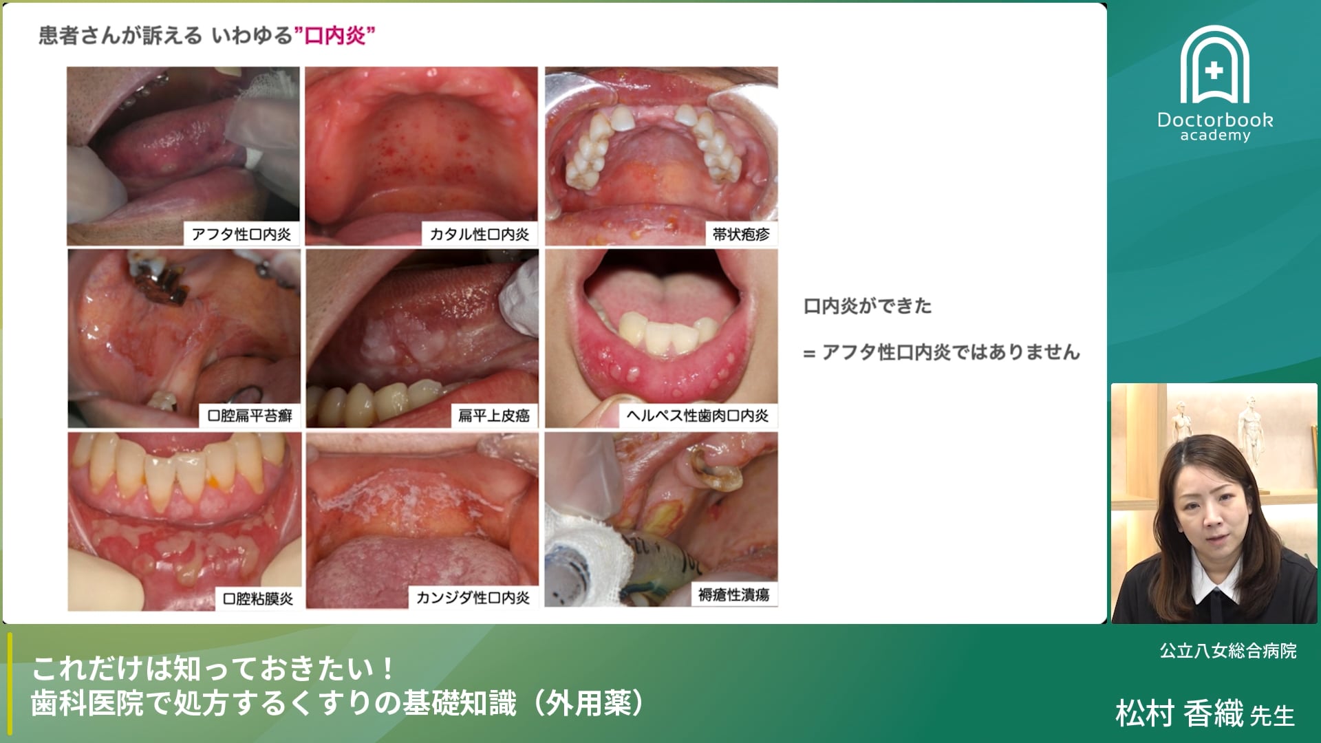 歯科医院で処方するくすりの基礎知識 外用薬編