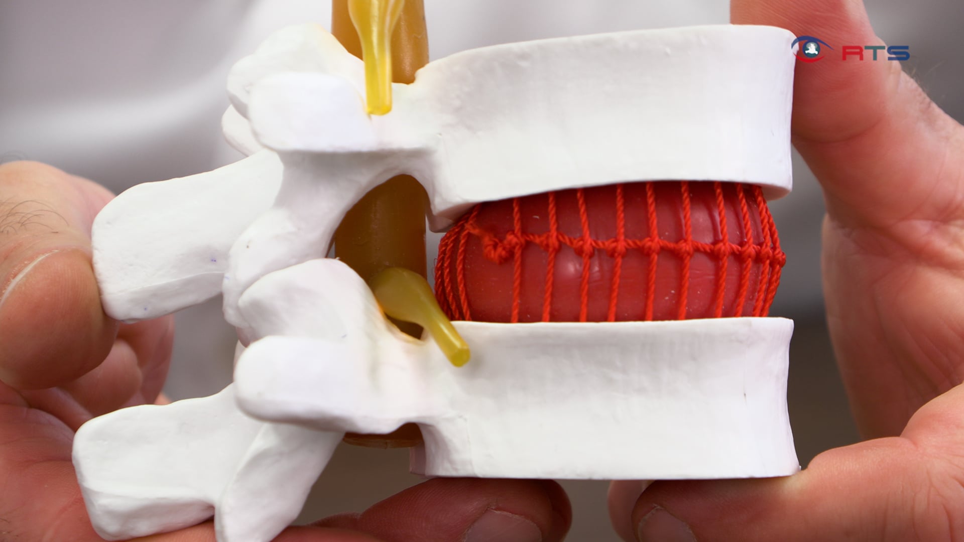 wenn-der-ruecken-streikt-talk-mit-den-spinedoctors-florian-hoffmann-und-christian-behrendt