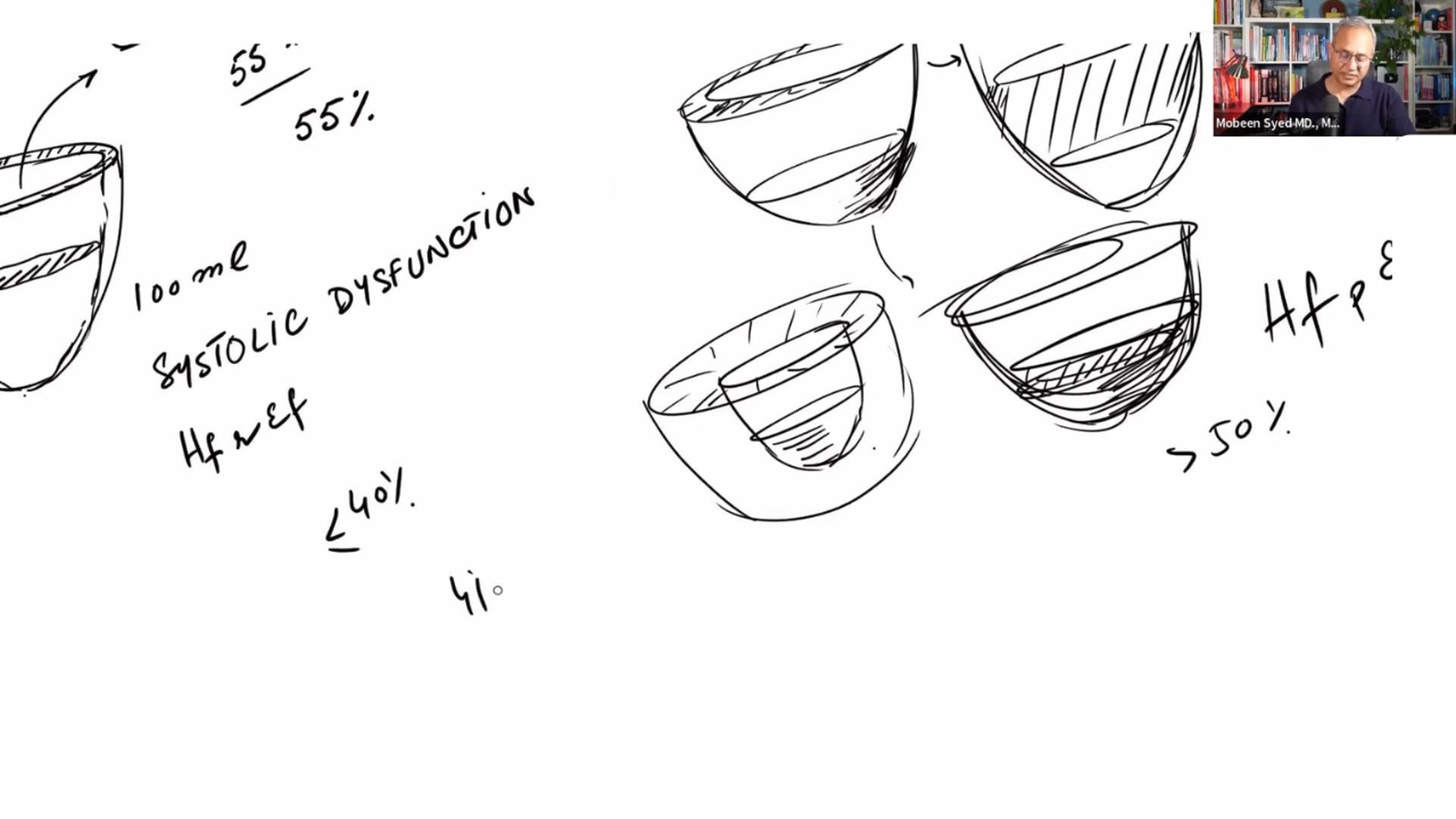 ACE Inhibitors in Heart Failure and Myocardial Infarction Mechanisms, Evidence, and Clinical Practice (PM 21)