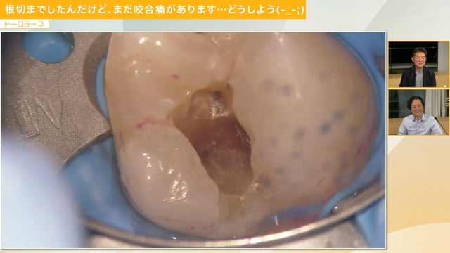 SCOPE　三橋兄弟による若手歯科医師に贈る診療のコツと心得　＜第59回公開！＞