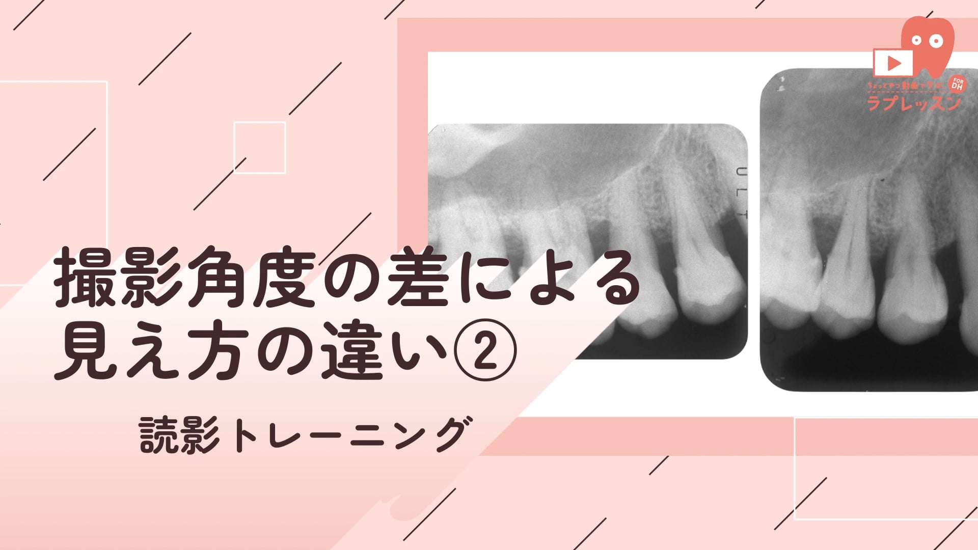 08.撮影角度による見え方の違い②