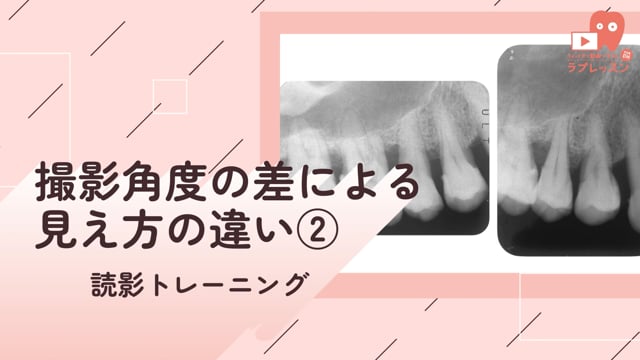 08.撮影角度による見え方の違い②