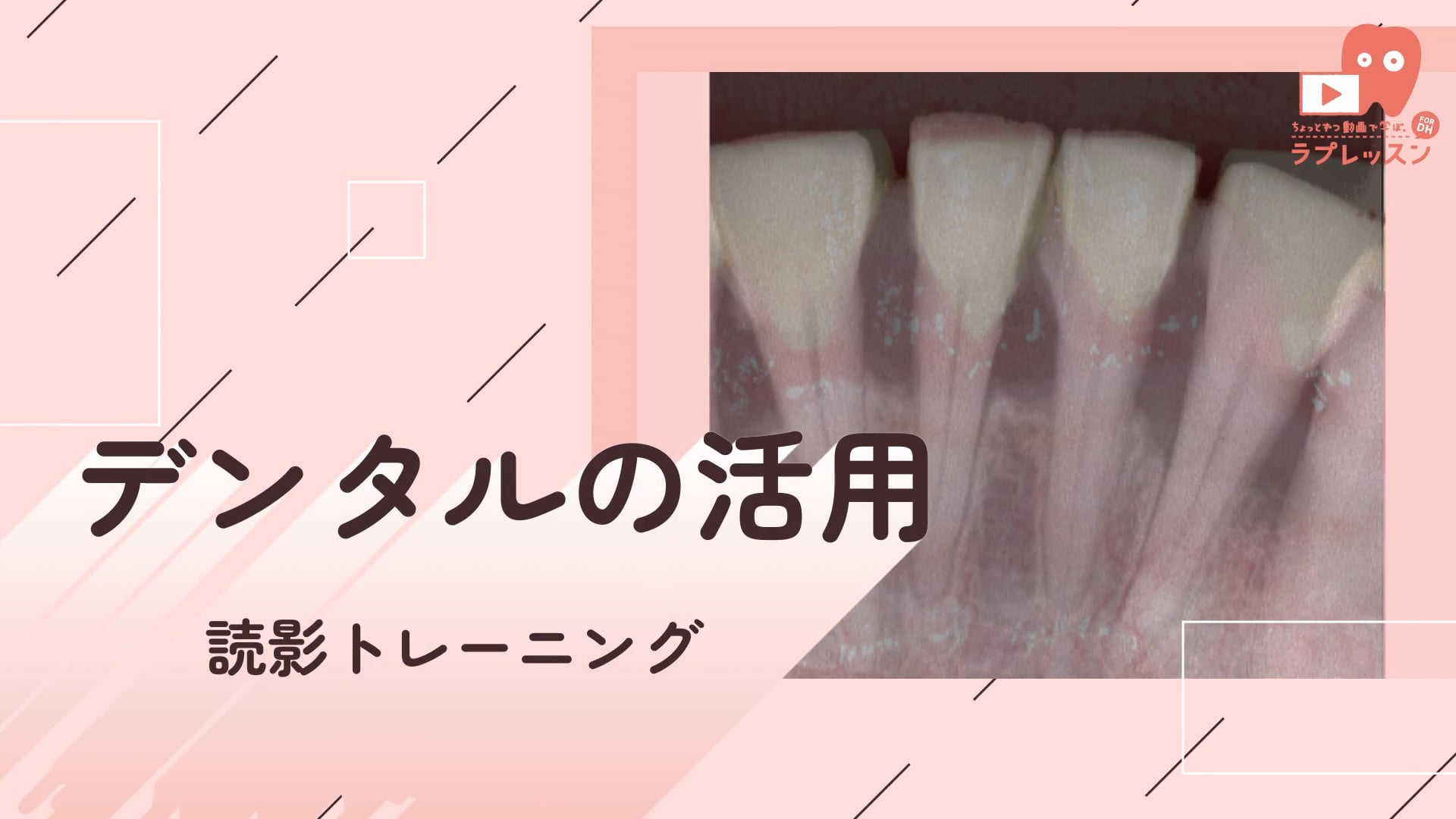 09.デンタルの活用