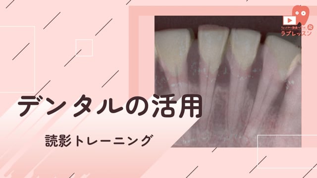 09.デンタルの活用