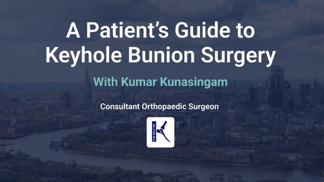Guide to Minimally Invasive Bunion Surgery