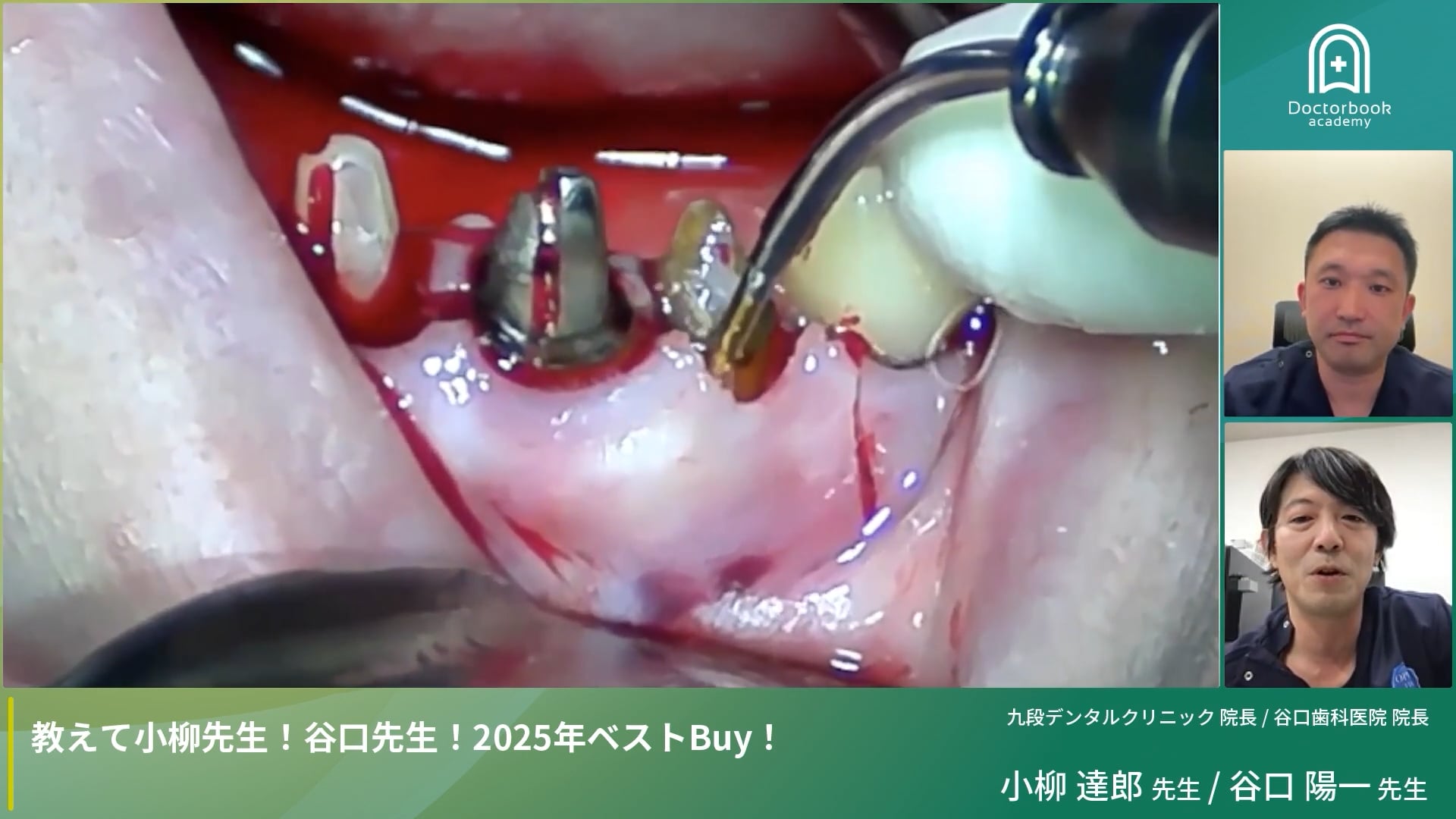 教えて小柳先生！谷口先生！2025年ベストBuy！