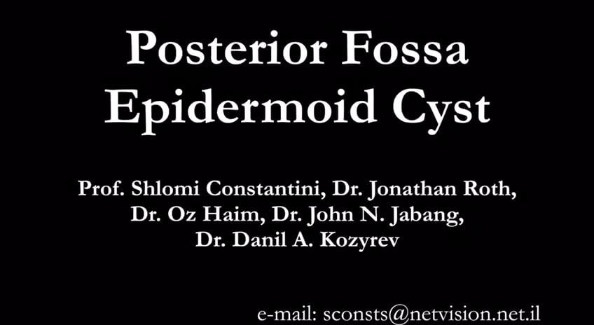 Posterior Fossa Epidermoid Cyst
