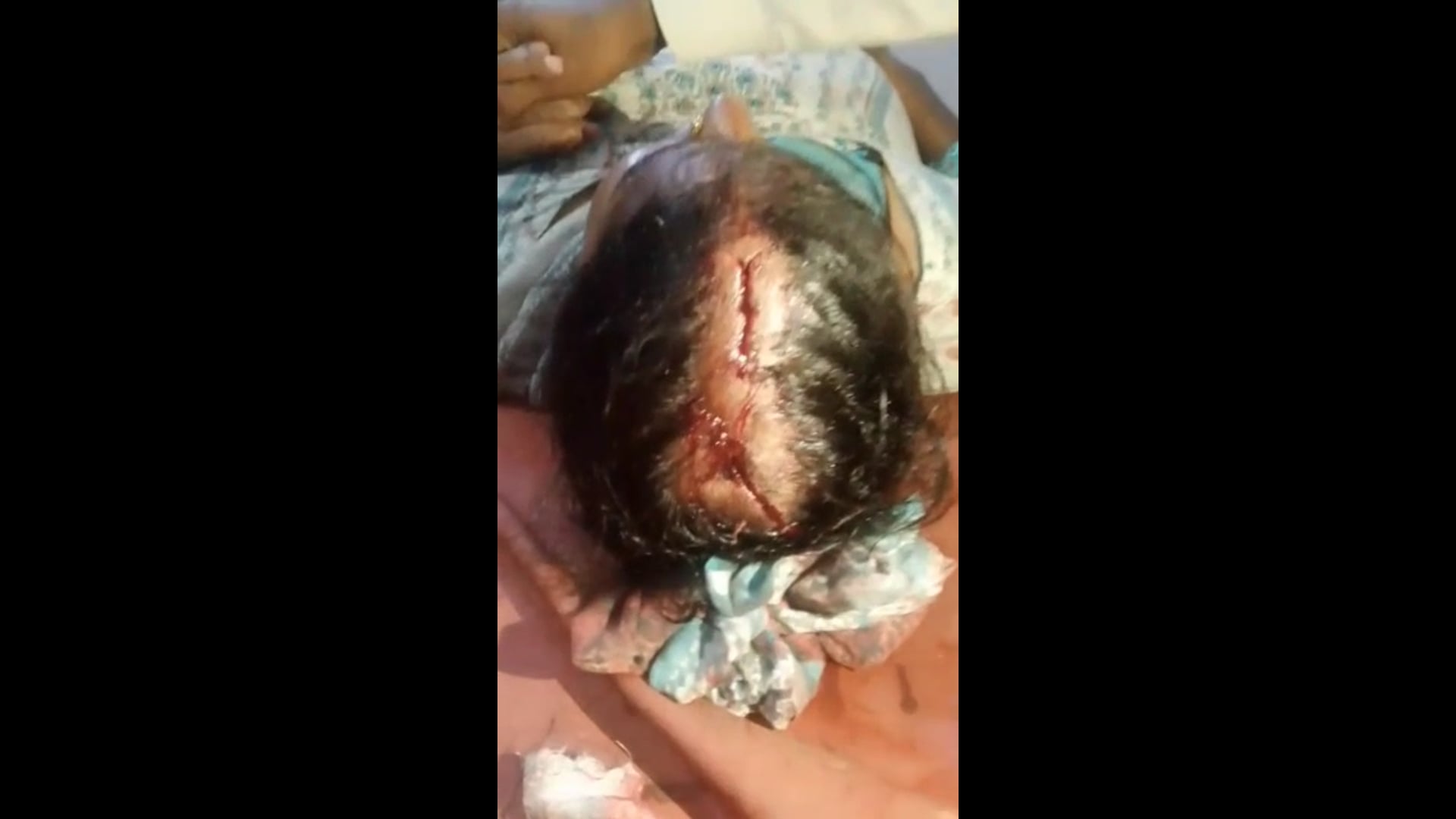 खेत विवाद में घर में घुसकर हमला, महिला की उंगली टूटी, चार के खिलाफ दी तहरीर, एफआईआर कर कार्रवाई की मांग