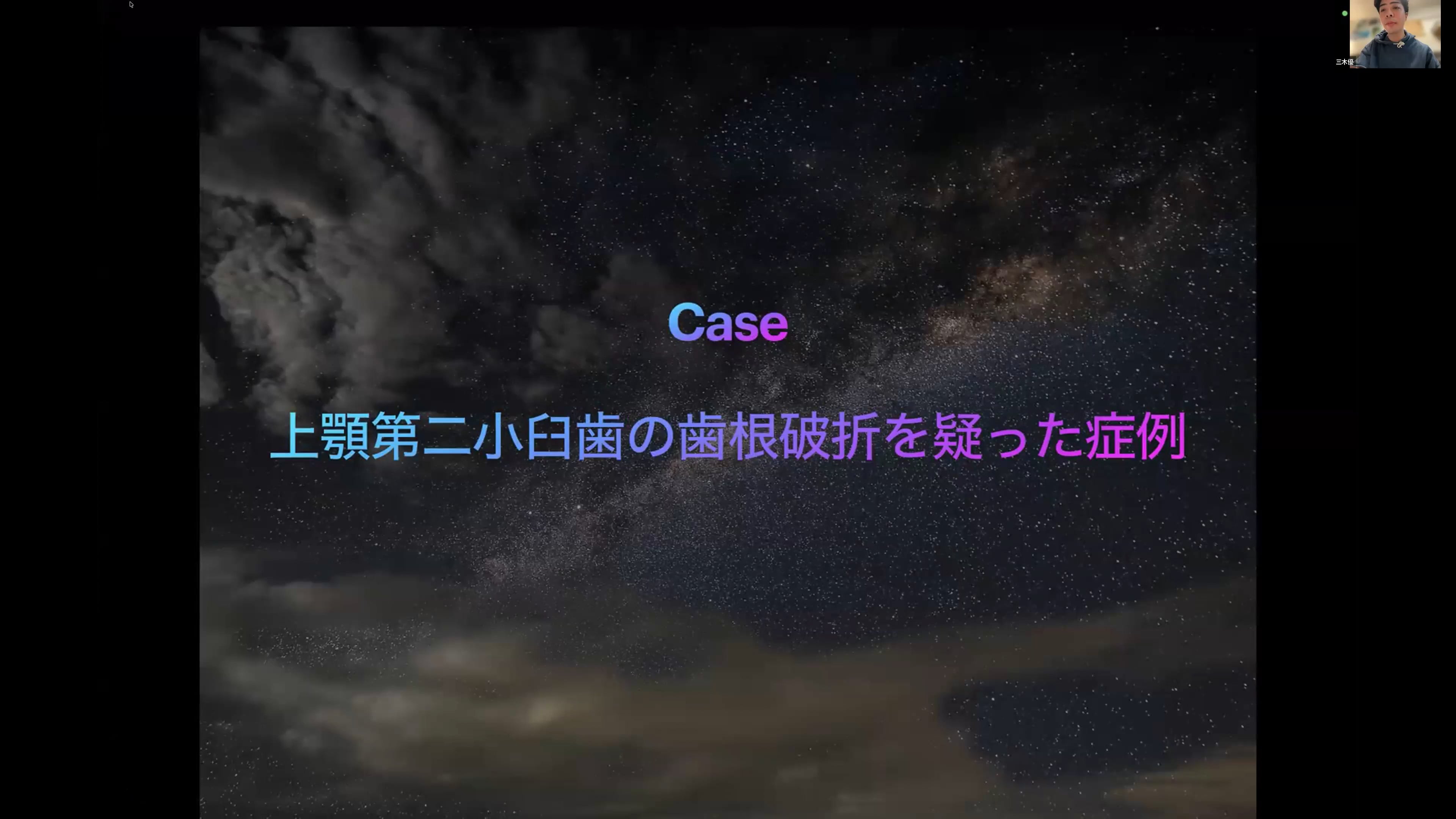上顎第二小臼歯の歯根破折を疑った症例｜村野浩気先生(Topics)