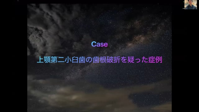 上顎第二小臼歯の歯根破折を疑った症例｜村野浩気先生(Topics)