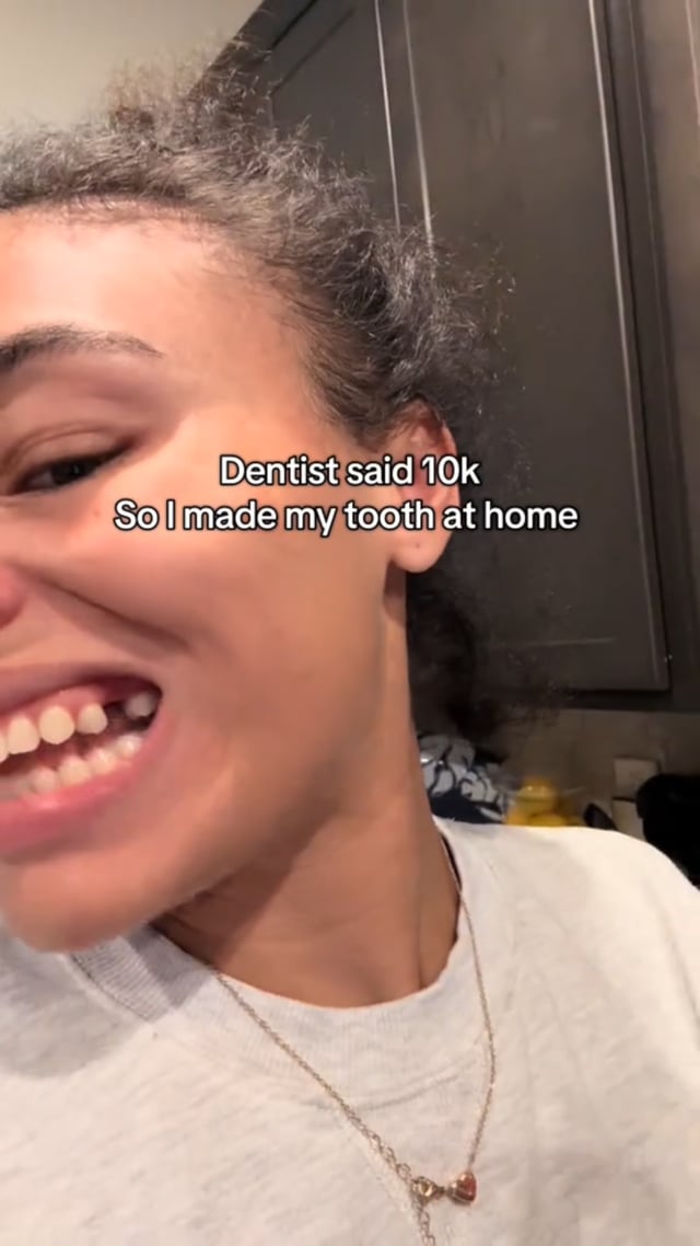 DIY Tooth Replacement