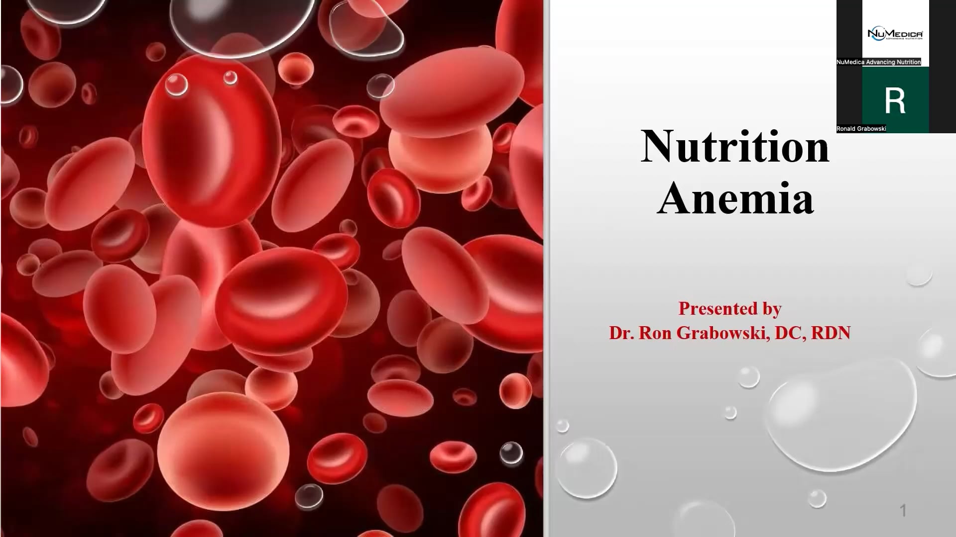 Nutritional Anemia: What our basic lab tests don’t tell us