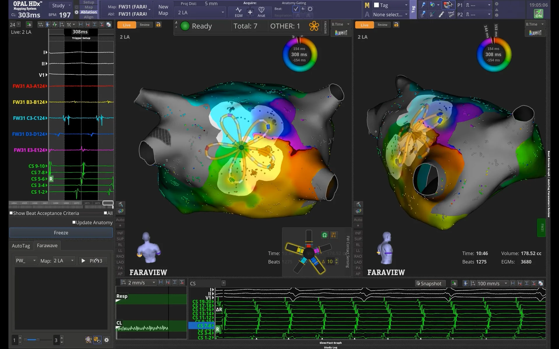 FARAWAVE™ NAV PFA Catheter - FARAPULSE™ PFA Platform