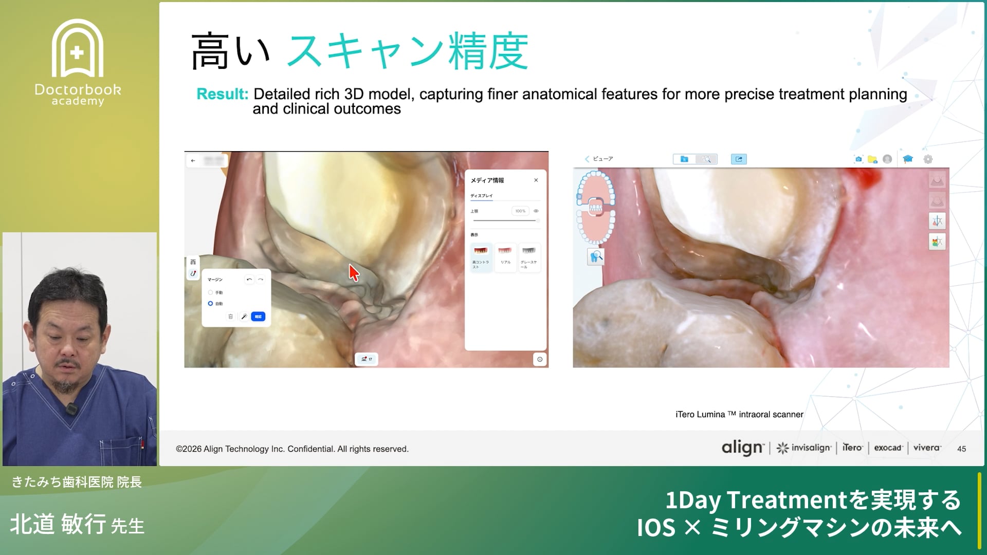 【1Dayトリートメントを実現する、IOS x ミリングマシンの未来へ】〜セミナー編〜