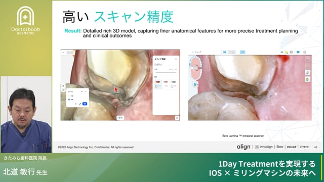 【1Dayトリートメントを実現する、IOS x ミリングマシンの未来へ】〜セミナー編〜