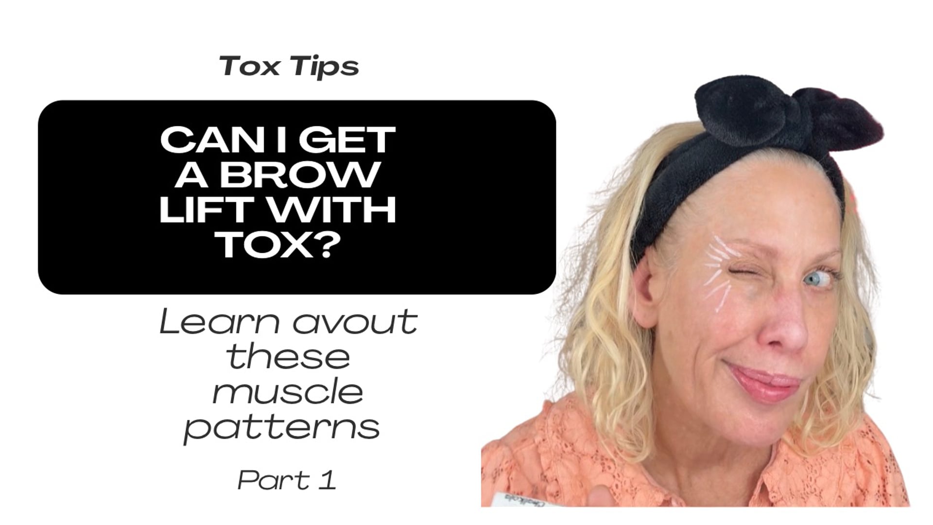 Brow Lift Potential: It All Comes Down to This