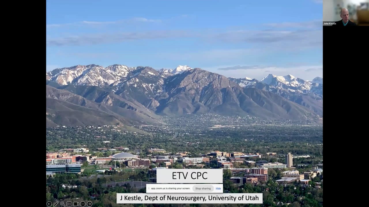 ISPN Webinar 4/26 – ETV and CPC Versus Shunt Placement – ETV + CPC