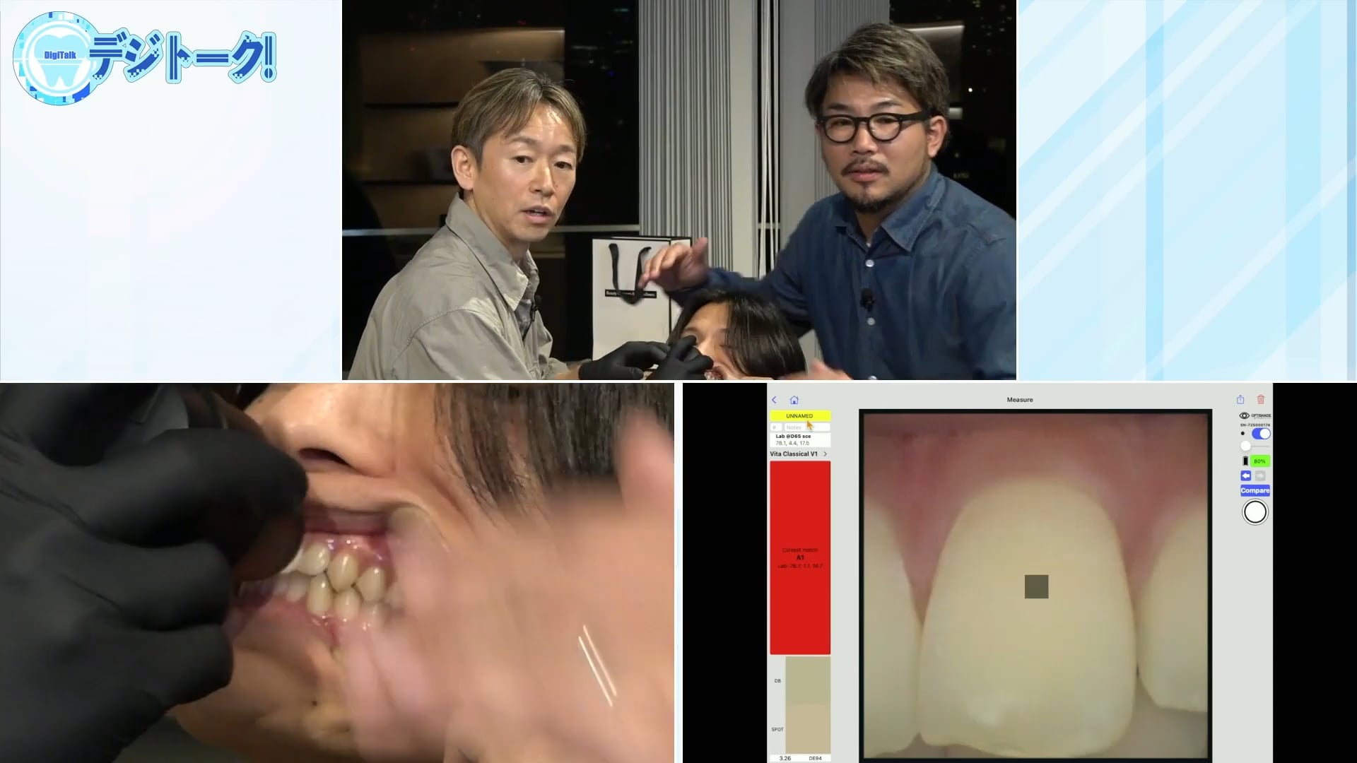 歯科医師にも知って欲しいデジタルシェードマッチングの世界