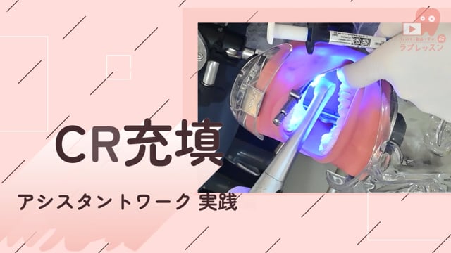 02.CR充填
