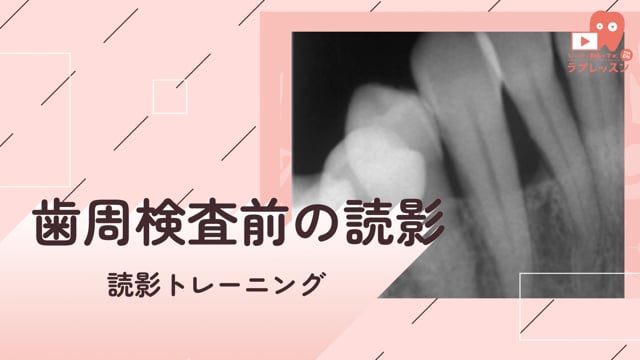 10.歯周検査前の読影