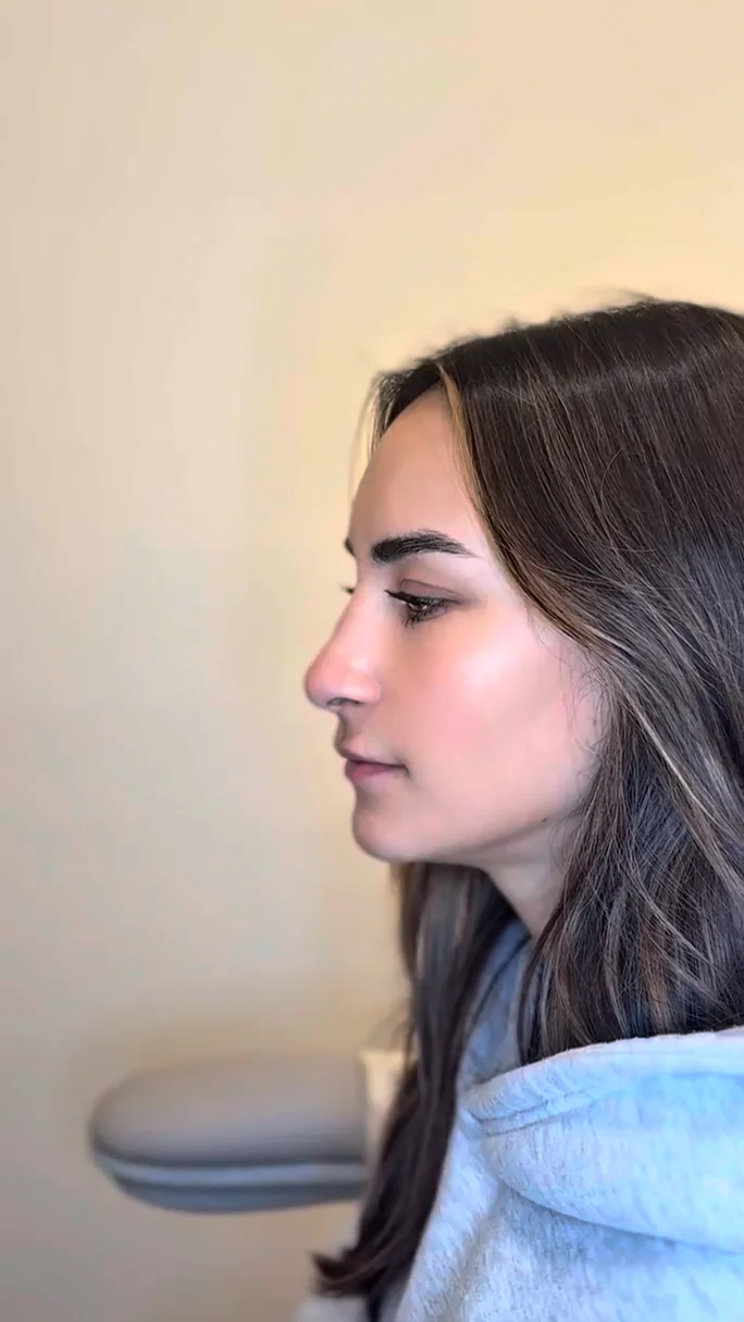 Zyra Clinic — Undetectable Injectables & Aesthetics in Redmond, WA