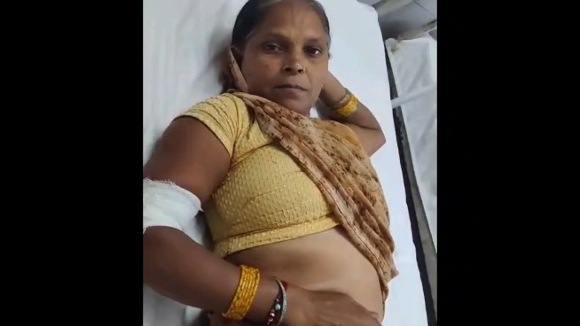  MANT-बंदर बने मौत का खतरा! फरह में फिर हमला, महिला गंभीर घायल,,