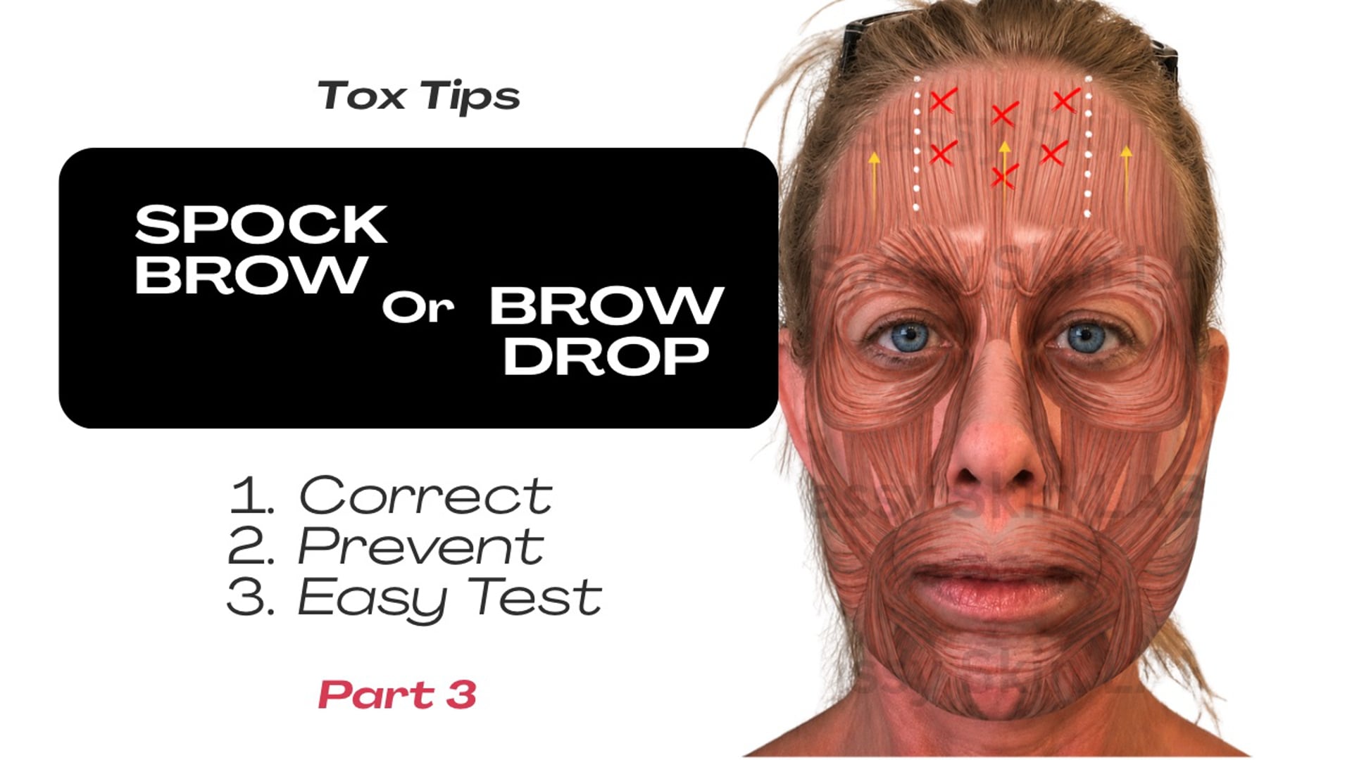 Spock Brow: Are You High Risk? Let Me Show You