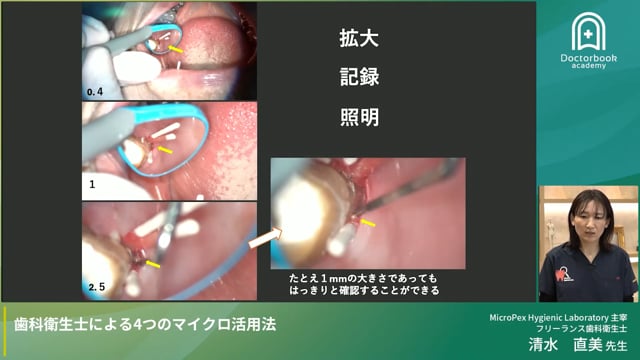 【プレセミナー】歯科衛生士による４つのマイクロ活用法