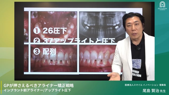 尾島賢治 プレミアム講演｜GPが押さえるべきアライナー矯正戦略［全4回］ DAY1　インプラント前アライナー/アップライト圧下