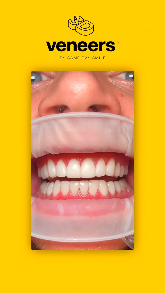 Vimeo Video Thumbnail