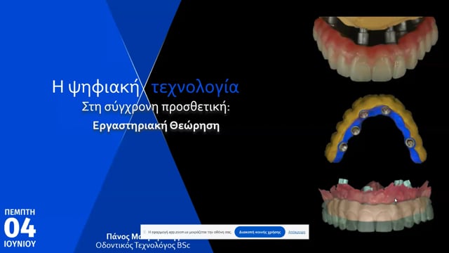 Η ψηφιακή τεχνολογία στη σύγχρονη προσθετική: Εργαστηριακή θεώρηση.