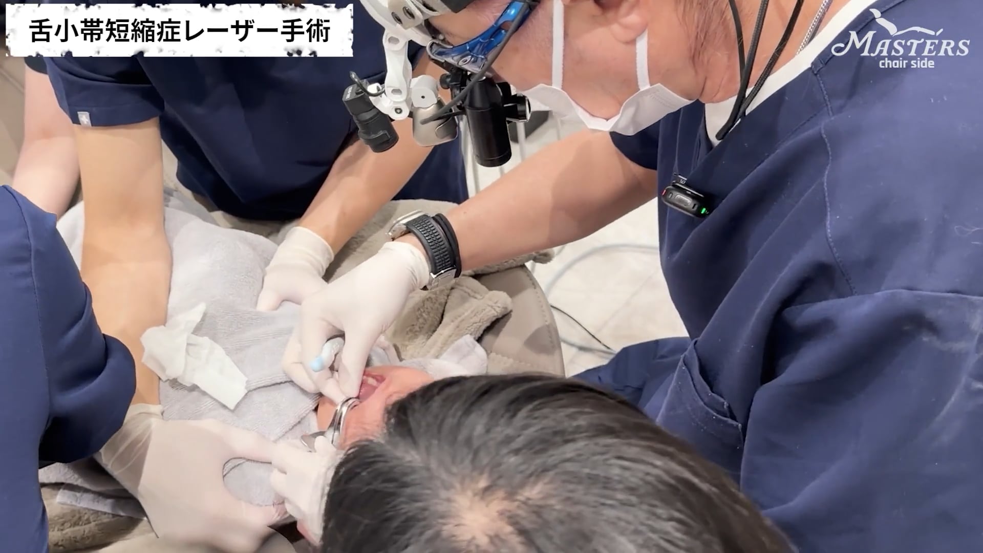 Part2 舌小帯切除術