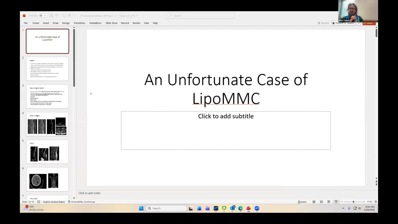 ISPN Webinar 5/26 – Spinal Dysraphism – An Unfortunate Case of LipoMMC – Case Discussion
