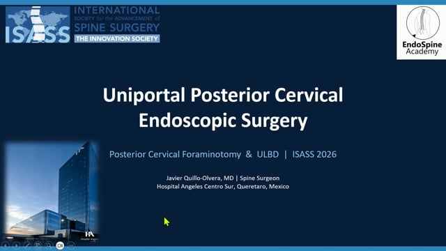 Uniportal Posterior Cervical Endoscopic Surgery