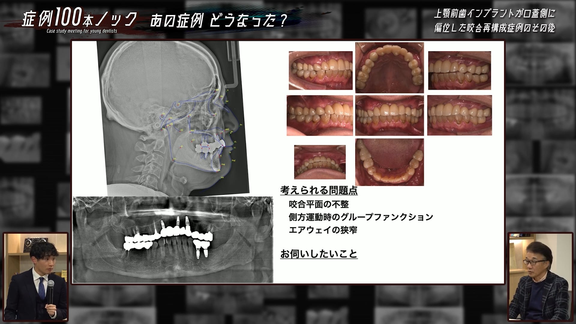 櫻井 祐弥先生 ～前歯部補綴症例のその後と長期予後を追う～