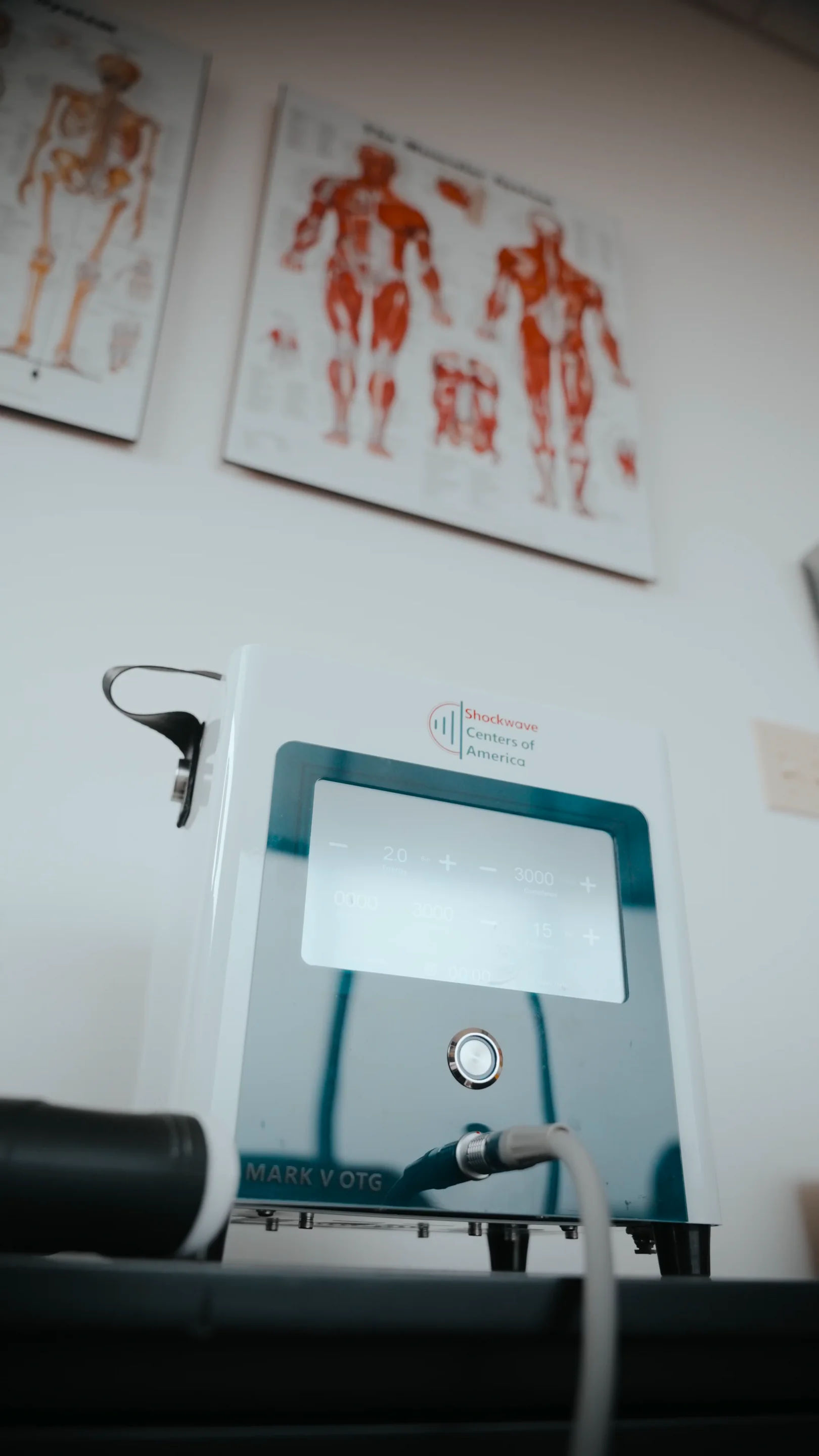 Shockwave Therapy
