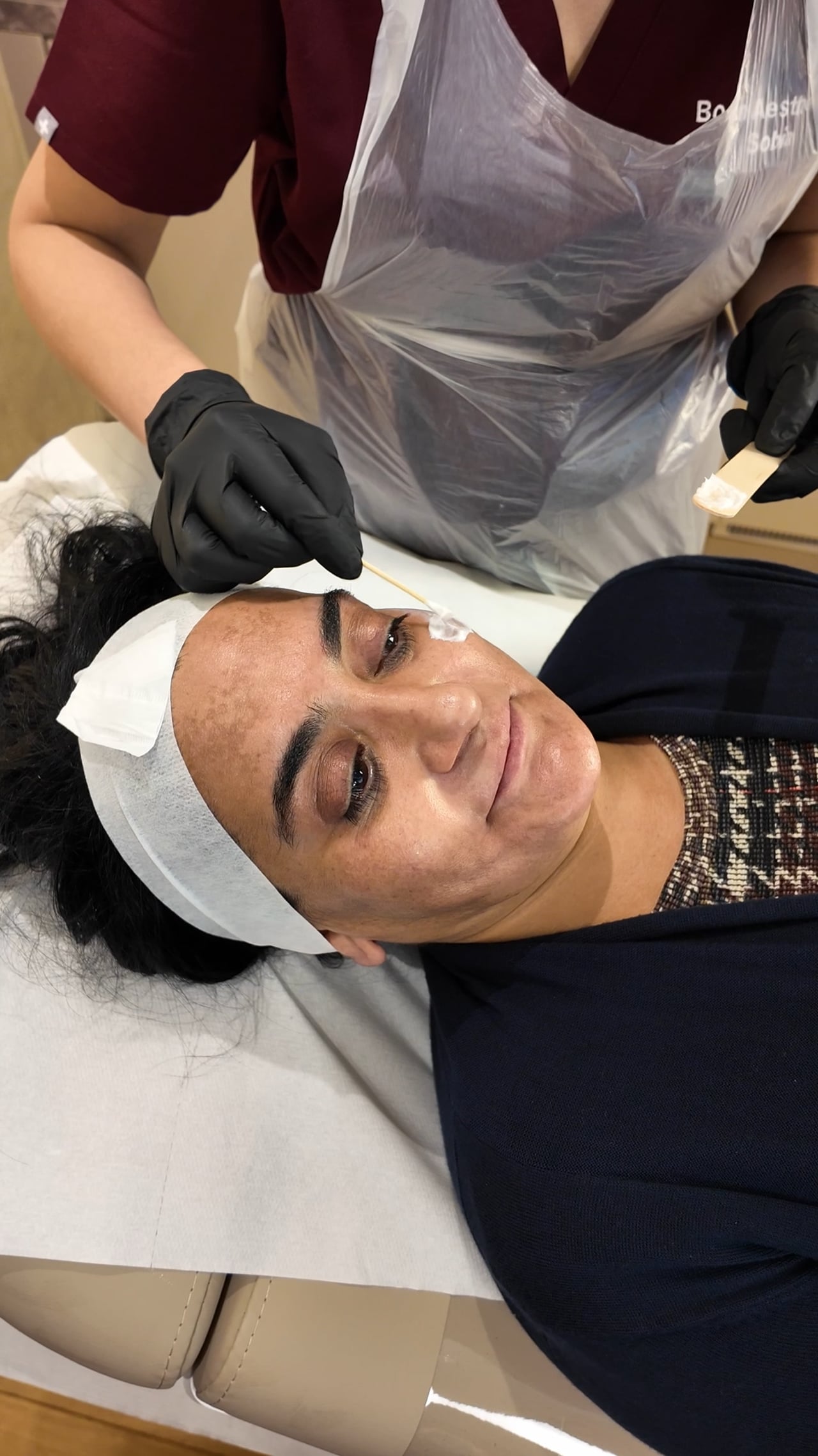 Cheek Filler