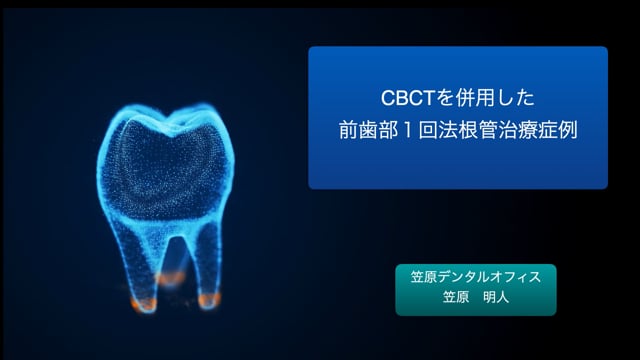 CBCTを併用した前歯部1回法根管治療症例｜笠原 明人先生(Archives)