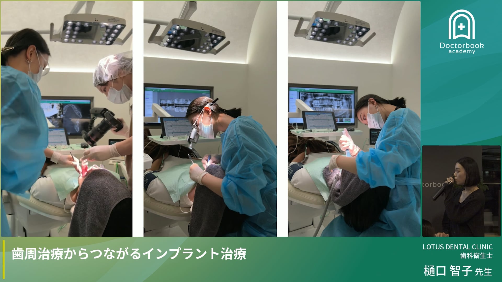 歯周治療からつながるインプラント治療