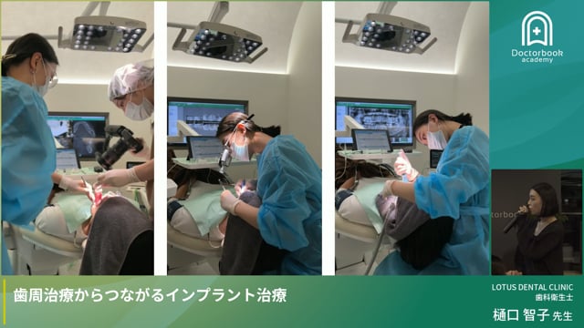 歯周治療からつながるインプラント治療