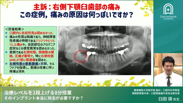 治療レベルを2段上げる8分授業 そのインプラント本当に除去が必要ですか？