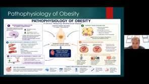 One Obesity Battle After Another