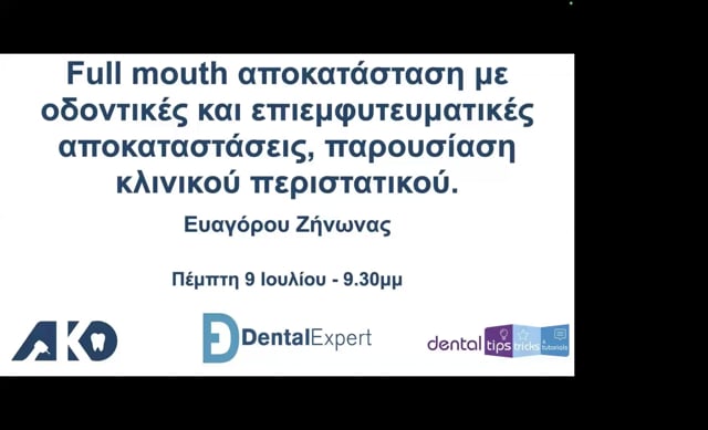 Full mouth αποκατάσταση με οδοντικές και επιεμφυτευματικές αποκαταστάσεις, παρουσίαση κλινικού περιστατικού.