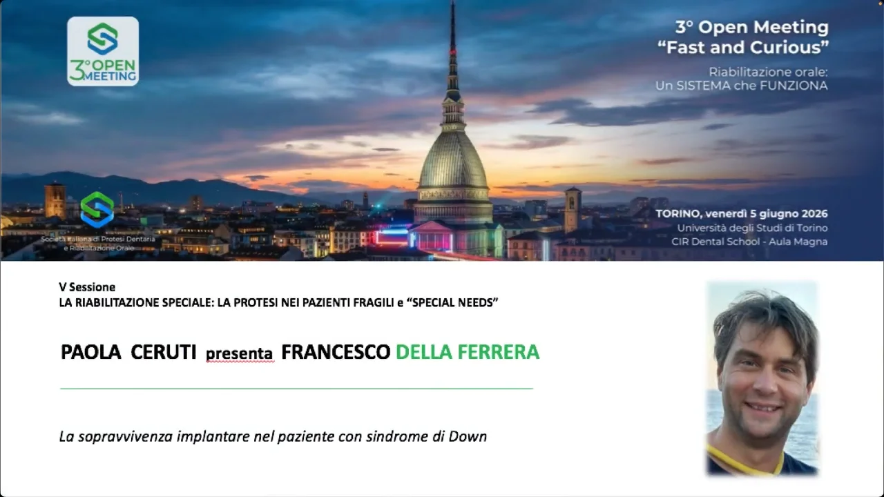 Anteprima video di Francesco Della Ferrera