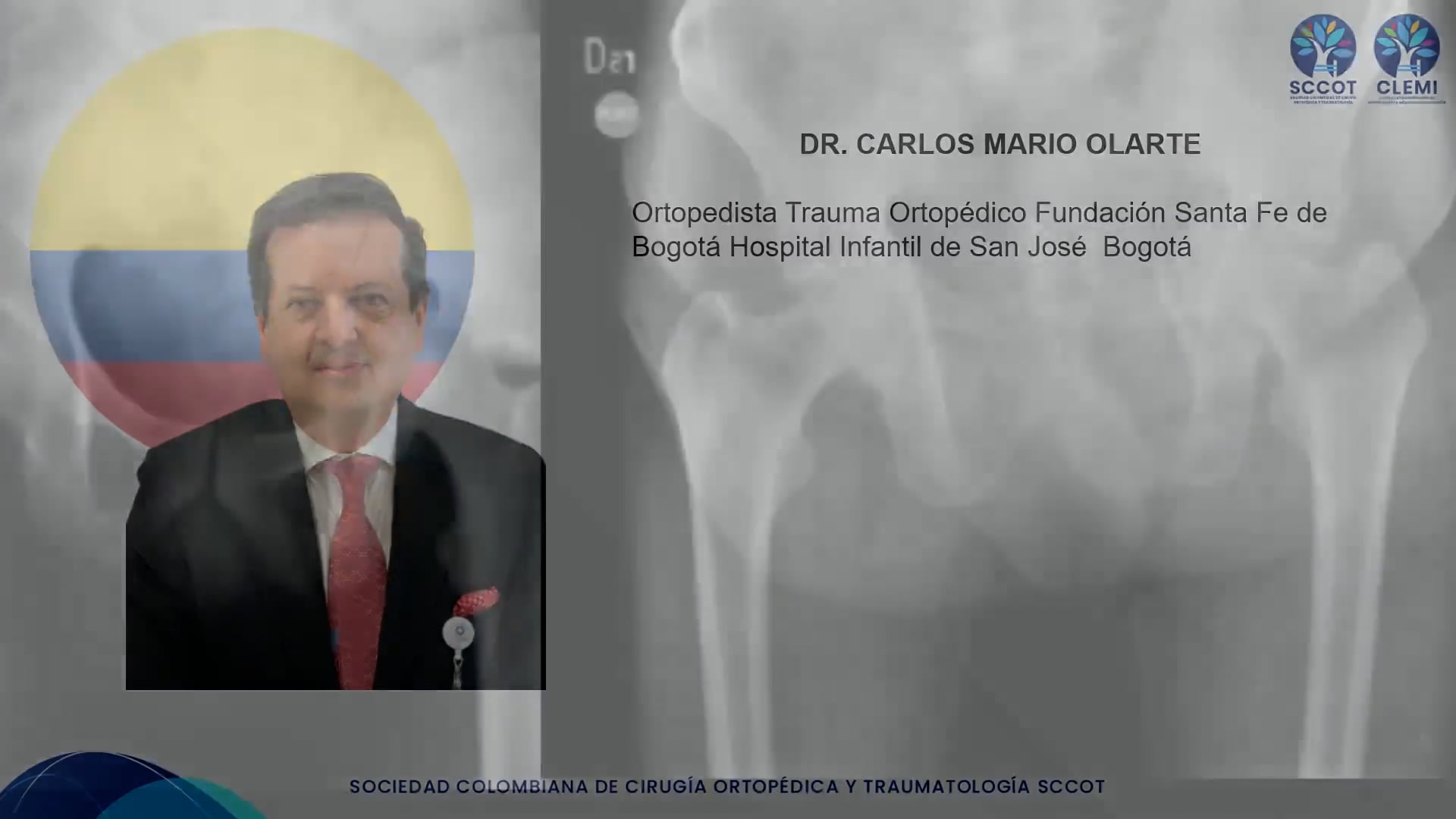 Fracturas de Placa Cuadrilátera: Abordajes Quirúrgicos