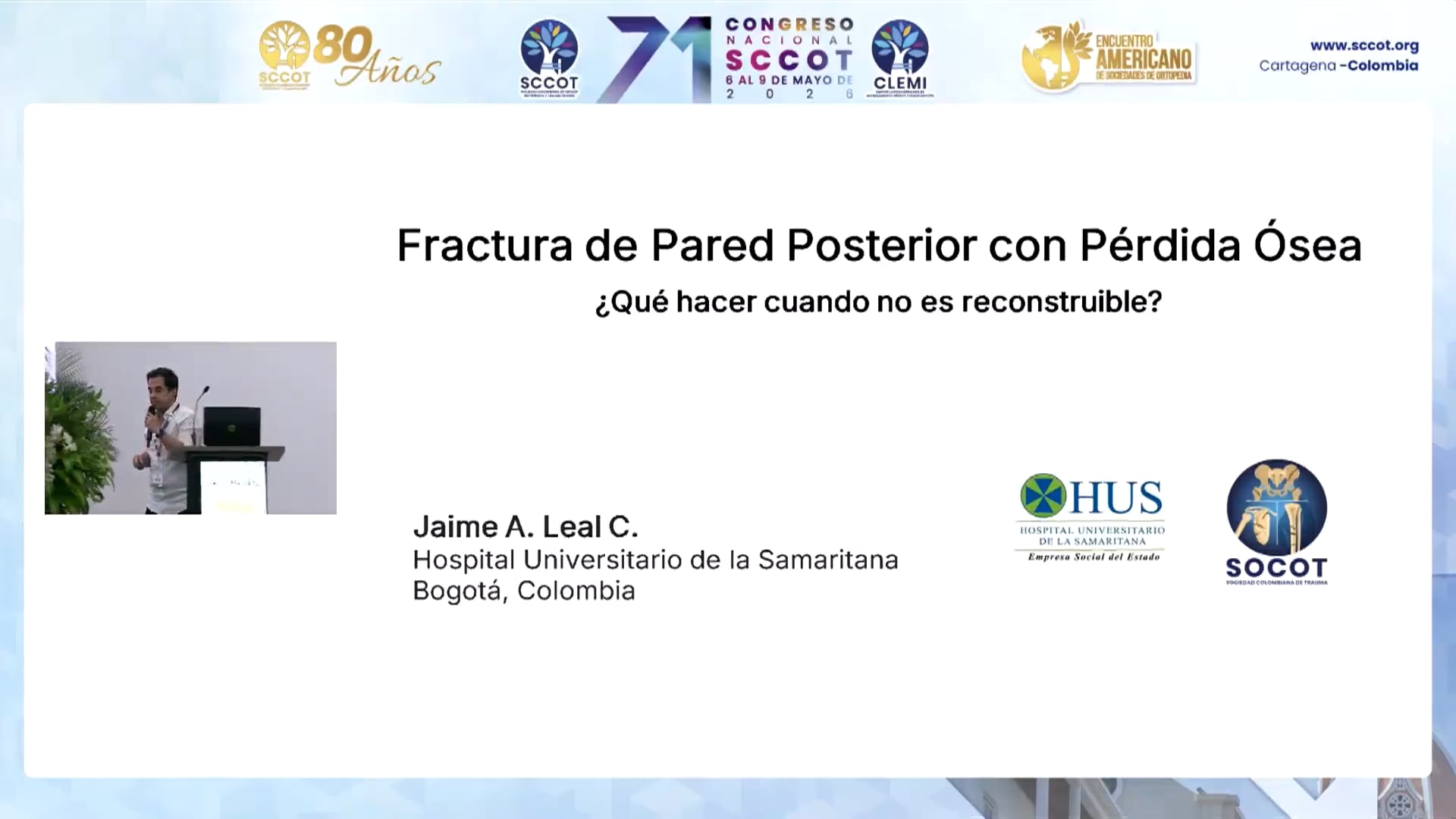 Fracturas de Pared Posterior del Acetábulo