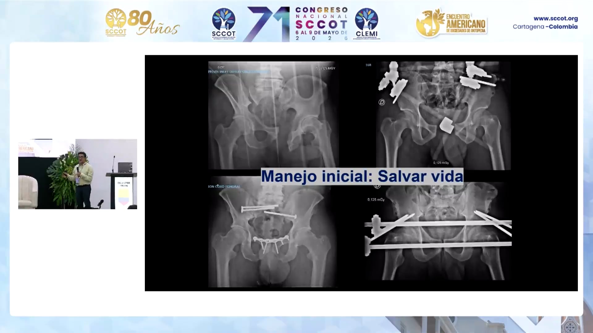Trauma y Embarazo: Riesgos y Manejo