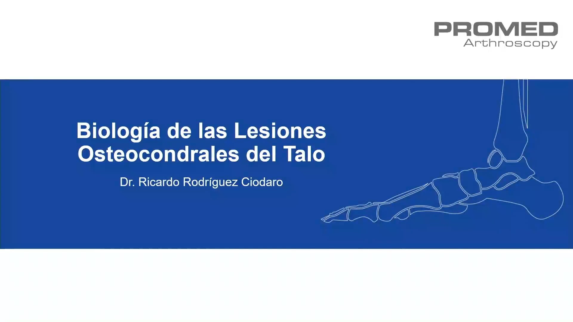 Tratamiento Quirúrgico Lesiones Osteocondrales Astrágalo